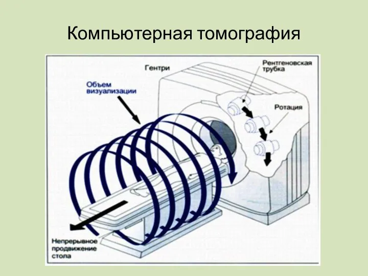 Компьютерная томография