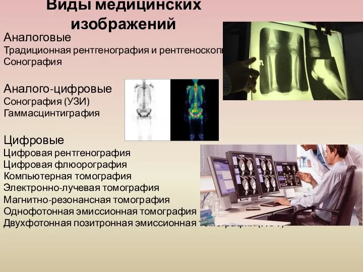 Виды медицинских изображений Аналоговые Традиционная рентгенография и рентгеноскопия Сонография Аналого-цифровые Сонография (УЗИ)