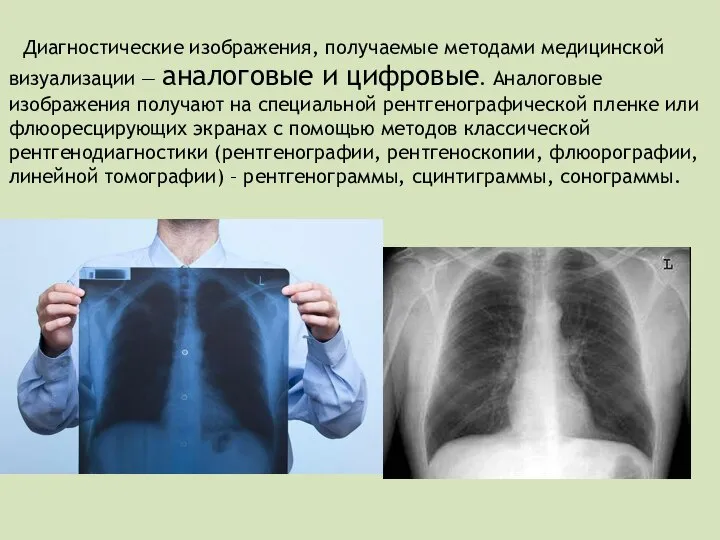 Диагностические изображения, получаемые методами медицинской визуализации — аналоговые и цифровые. Аналоговые изображения