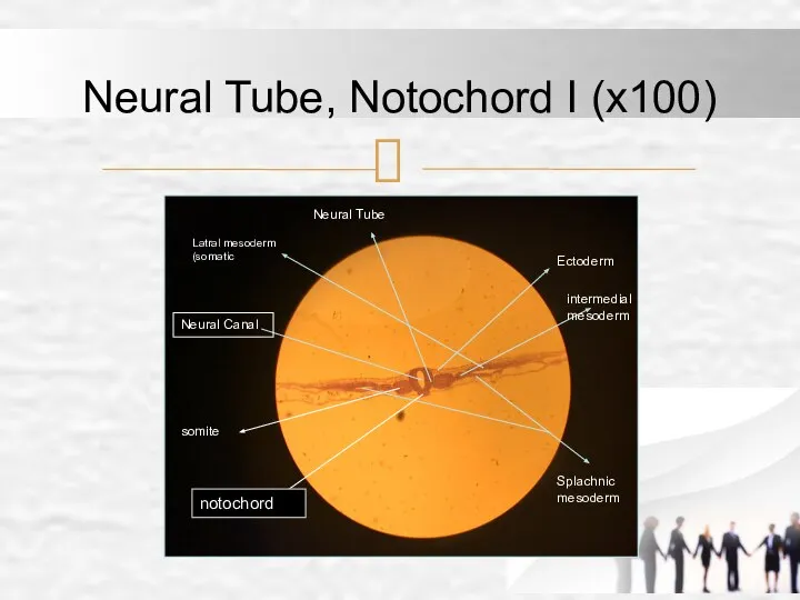 Neural Tube, Notochord I (x100) notochord Neural Canal Neural Tube Latral mesoderm