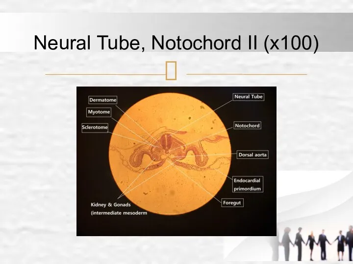 Neural Tube, Notochord II (x100)