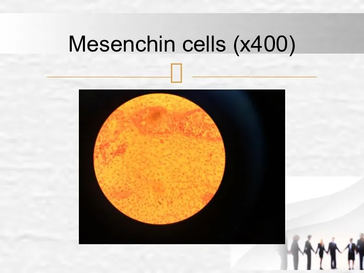 Mesenchin cells (x400)