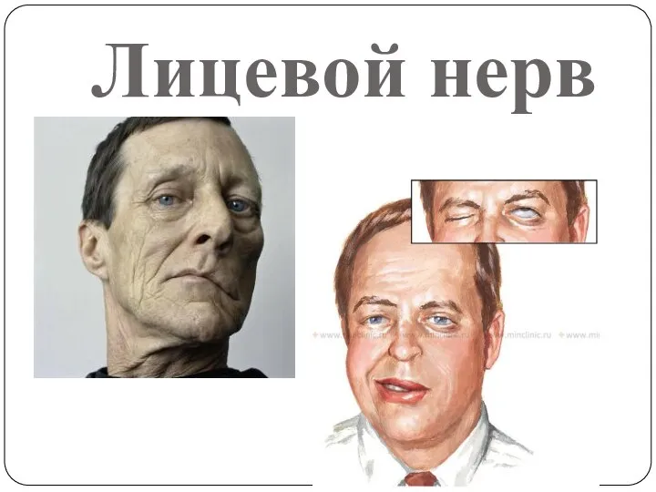 Лицевой нерв