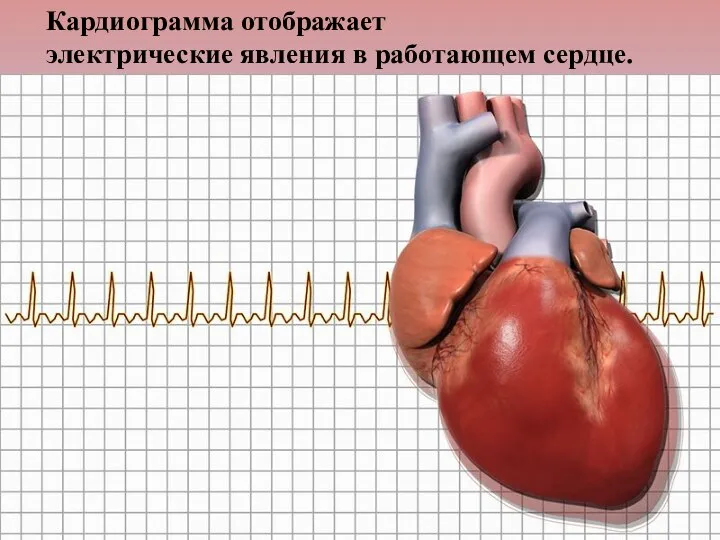 Кардиограмма отображает электрические явления в работающем сердце.