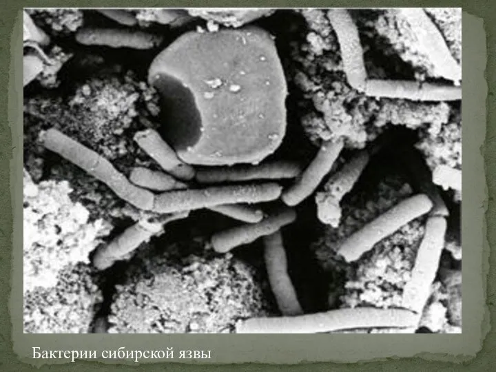 Бактерии сибирской язвы