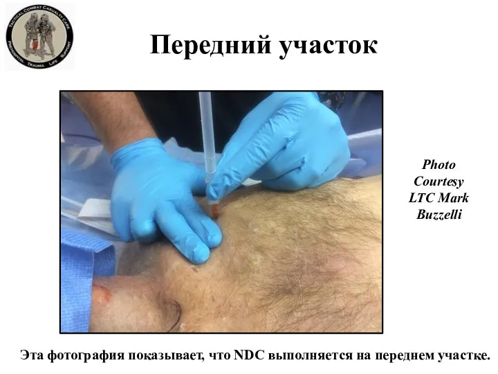 Передний участок Эта фотография показывает, что NDC выполняется на переднем участке. Photo Courtesy LTC Mark Buzzelli