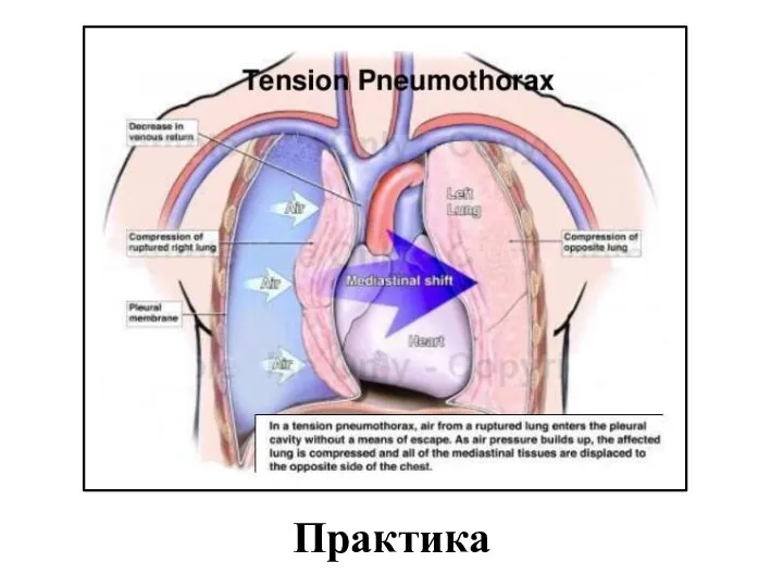 Практика