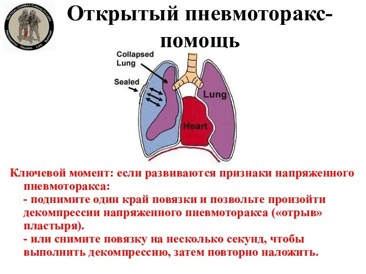 Открытый пневмоторакс- помощь Ключевой момент: если развиваются признаки напряженного пневмоторакса: - поднимите