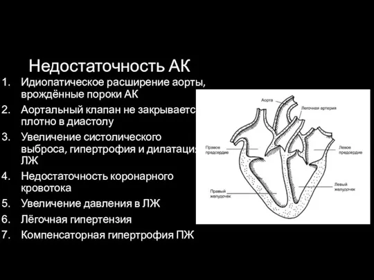 Недостаточность АК Идиопатическое расширение аорты, врождённые пороки АК Аортальный клапан не закрывается