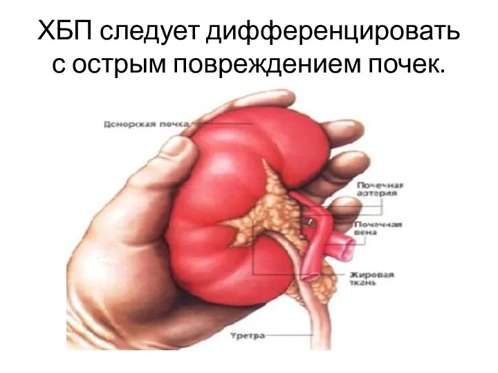 ХБП следует дифференцировать с острым повреждением почек.