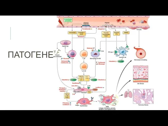 ПАТОГЕНЕЗ