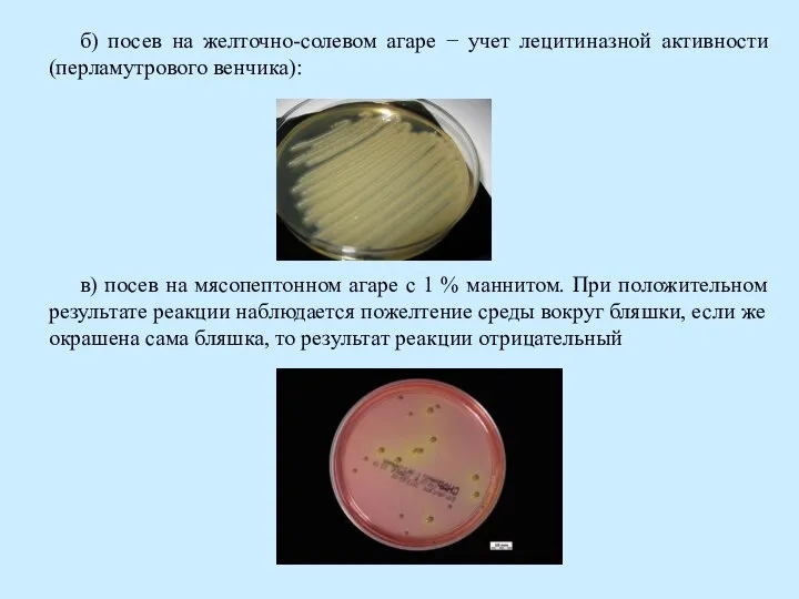 б) посев на желточно-солевом агаре − учет лецитиназной активности (перламутрового венчика): в)