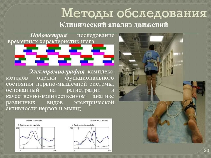 Клинический анализ движений Подометрия исследование временных характеристик шага Электромиография комплекс методов оценки