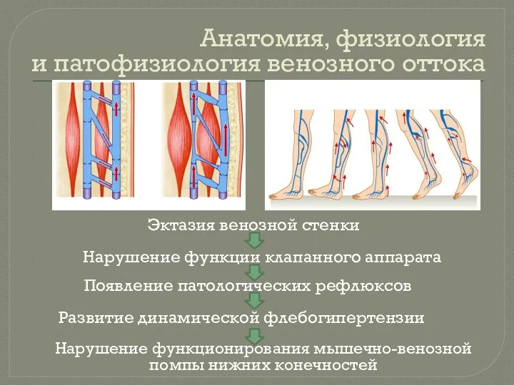 Эктазия венозной стенки Анатомия, физиология и патофизиология венозного оттока Нарушение функционирования мышечно-венозной