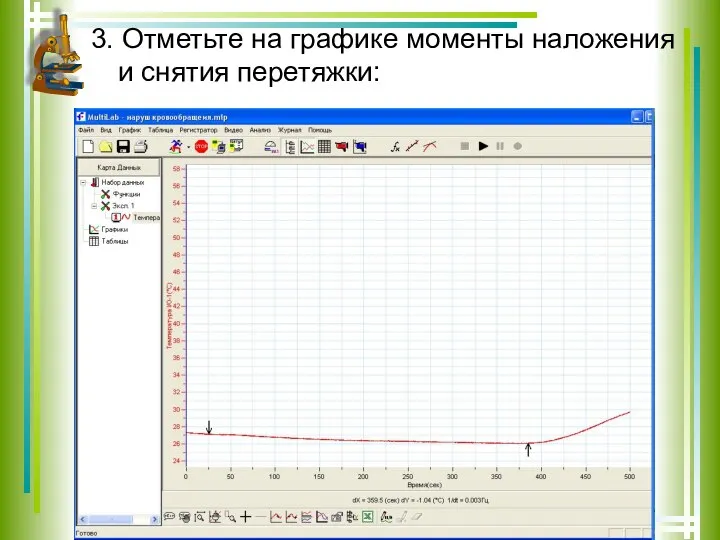 3. Отметьте на графике моменты наложения и снятия перетяжки: