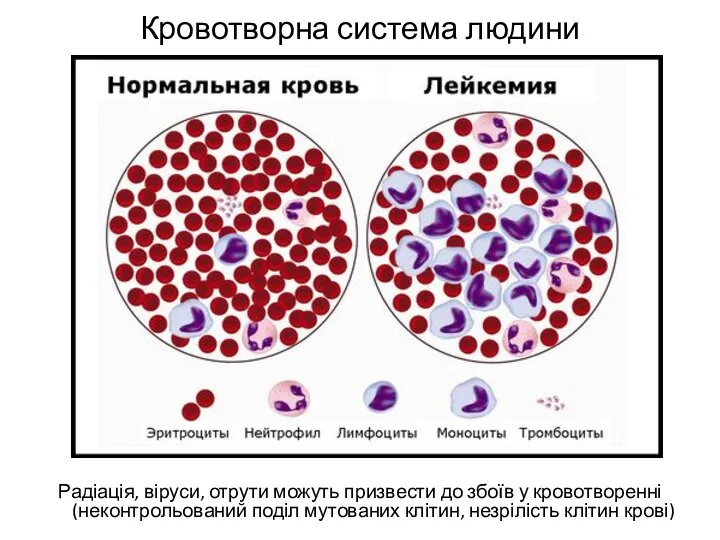 Кровотворна система людини Радіація, віруси, отрути можуть призвести до збоїв у кровотворенні