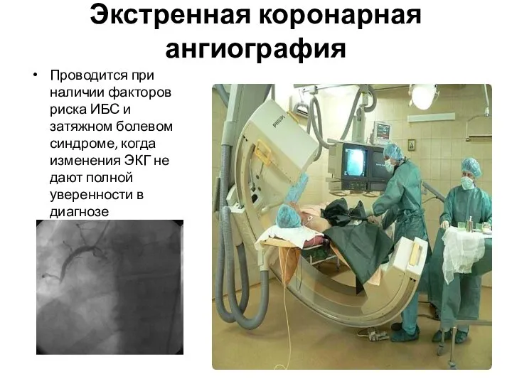 Экстренная коронарная ангиография Проводится при наличии факторов риска ИБС и затяжном болевом