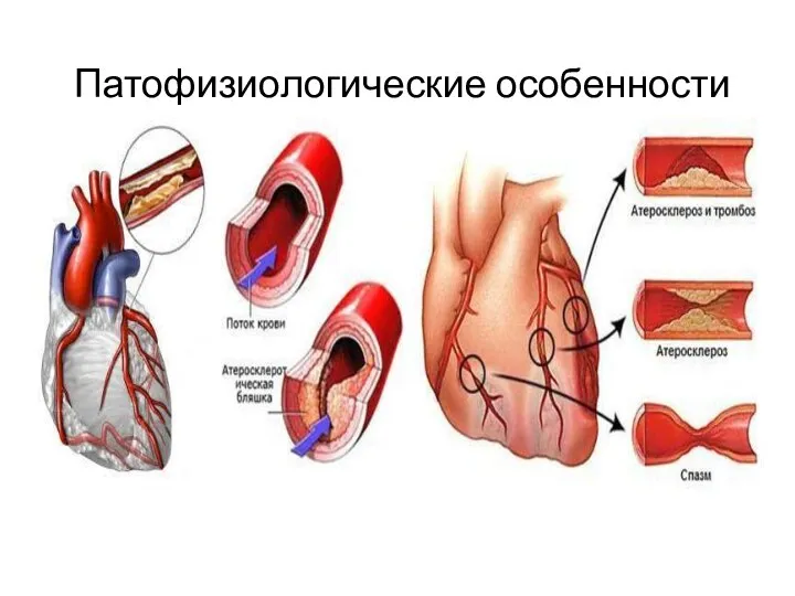 Патофизиологические особенности