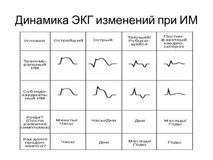 Динамика ЭКГ изменений при ИМ