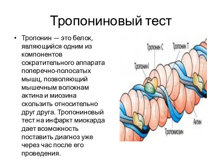 Тропониновый тест Тропонин — это белок, являющийся одним из компонентов сократительного аппарата