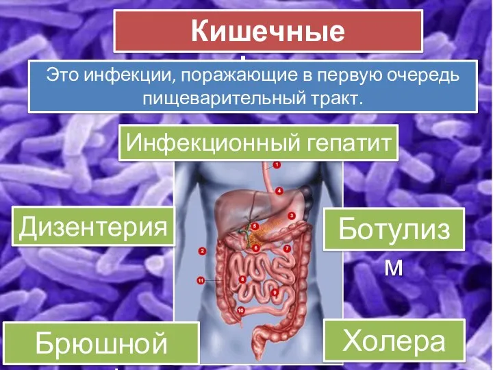 Кишечные инфекции Это инфекции, поражающие в первую очередь пищеварительный тракт. Брюшной тиф