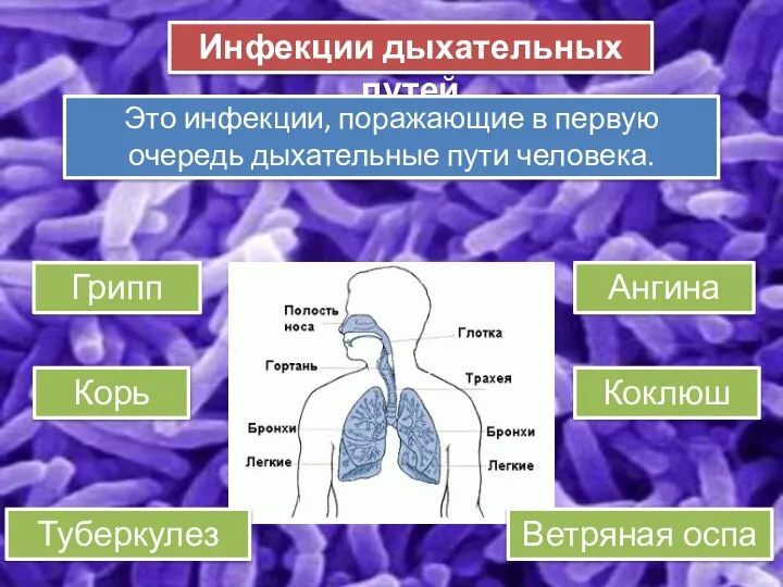 Грипп Инфекции дыхательных путей Корь Ангина Коклюш Ветряная оспа Туберкулез Это инфекции,