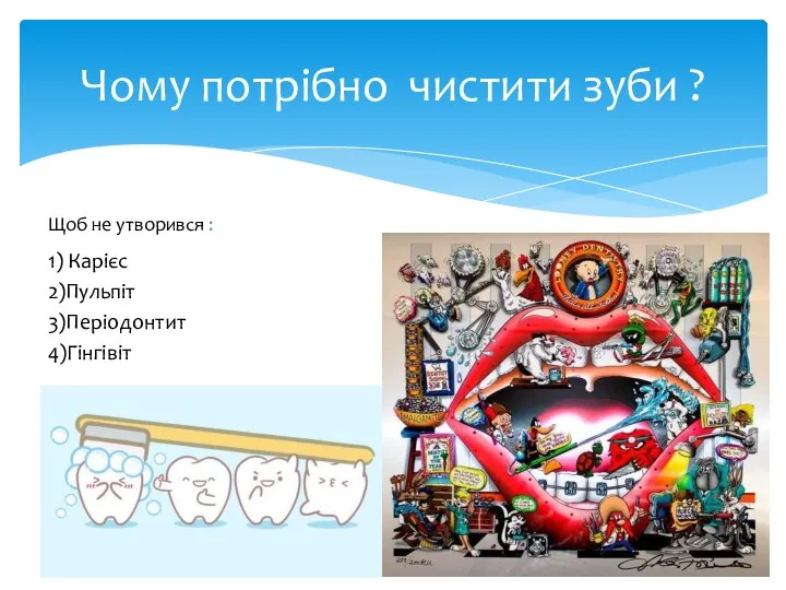 Чому потрібно чистити зуби ? 1) Карієс 2)Пульпіт 3)Періодонтит 4)Гінгівіт Щоб не утворився :