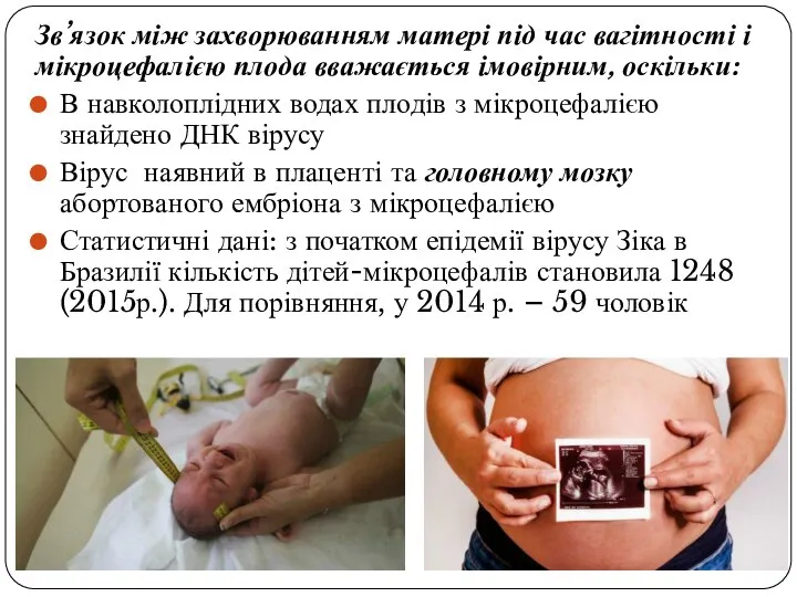 Зв’язок між захворюванням матері під час вагітності і мікроцефалією плода вважається імовірним,