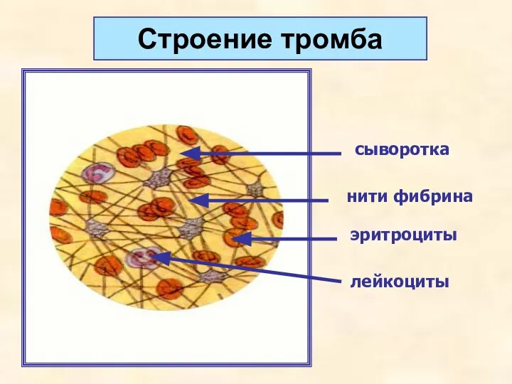 Строение тромба нити фибрина эритроциты лейкоциты сыворотка