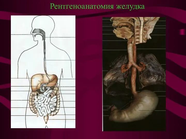 Рентгеноанатомия желудка