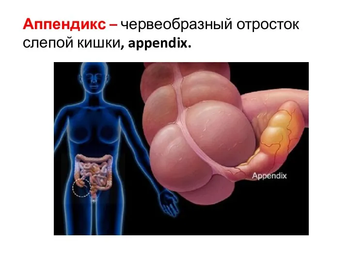 Аппендикс – червеобразный отросток слепой кишки, appendix.