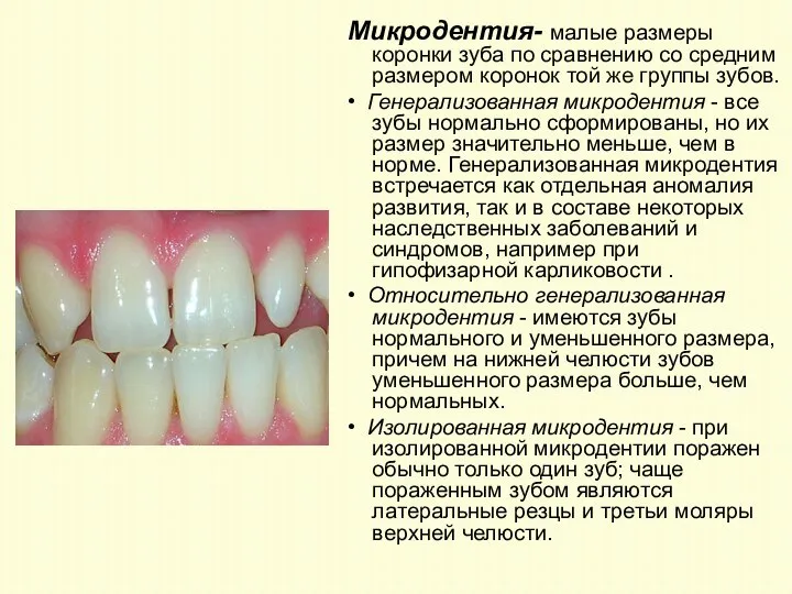 Микродентия- малые размеры коронки зуба по сравнению со средним размером коронок той