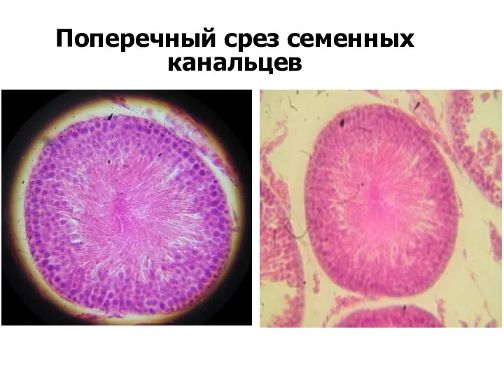 Поперечный срез семенных канальцев