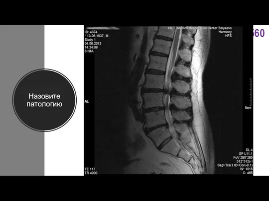 Назовите патологию
