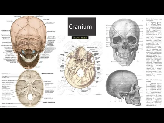 Cranium