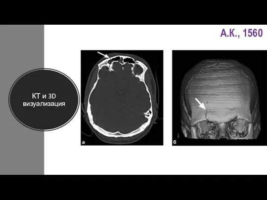 КТ и 3D визуализация