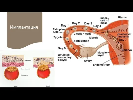 Имплантация