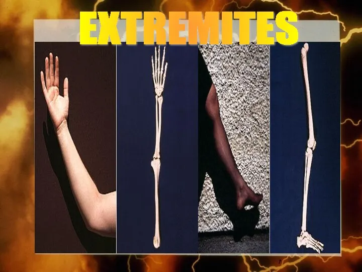 EXTREMITES