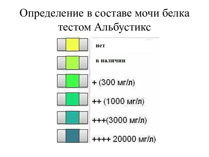 Определение в составе мочи белка тестом Альбустикс