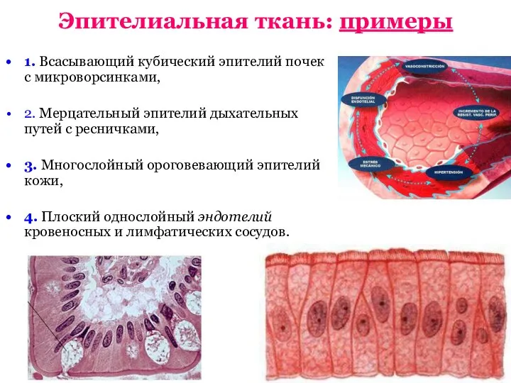 Эпителиальная ткань: примеры 1. Всасывающий кубический эпителий почек с микроворсинками, 2. Мерцательный