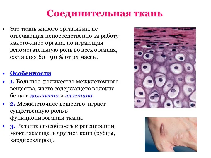 Соединительная ткань Это ткань живого организма, не отвечающая непосредственно за работу какого-либо