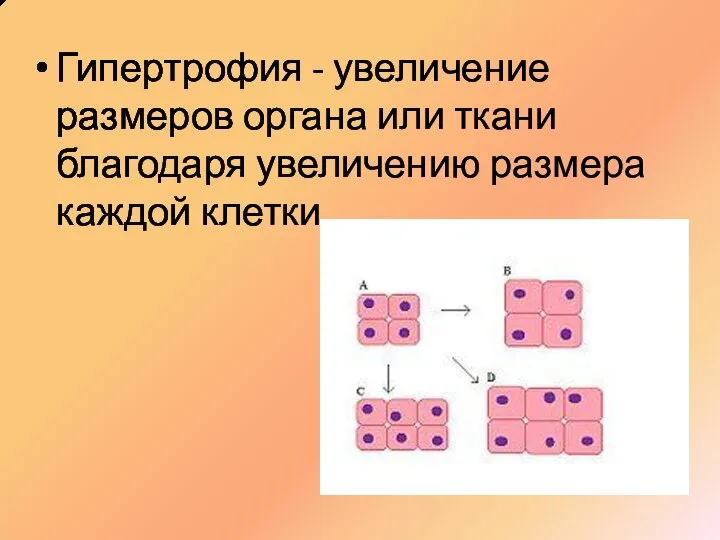 Гипертрофия - увеличение размеров органа или ткани благодаря увеличению размера каждой клетки