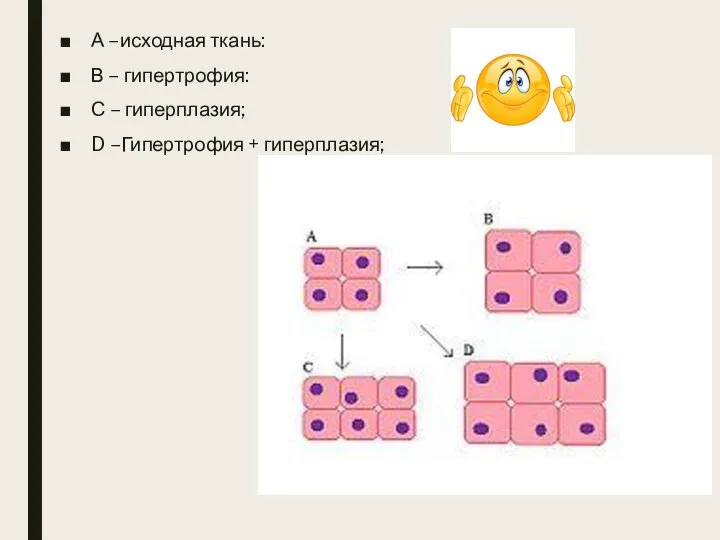 А –исходная ткань: В – гипертрофия: С – гиперплазия; D –Гипертрофия + гиперплазия;