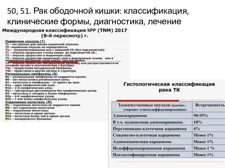 50, 51. Рак ободочной кишки: классификация, клинические формы, диагностика, лечение