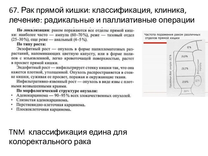 67. Рак прямой кишки: классификация, клиника, лечение: радикальные и паллиативные операции TNM