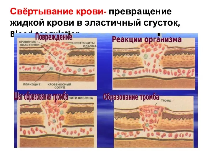 Свёртывание крови- превращение жидкой крови в эластичный сгусток, Blood coagulation.