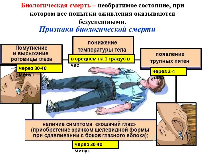 Биологическая смерть – необратимое состояние, при котором все попытки оживления оказываются безуспешными.