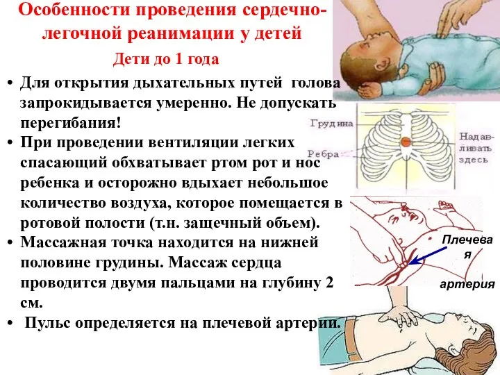 Особенности проведения сердечно-легочной реанимации у детей Для открытия дыхательных путей голова запрокидывается