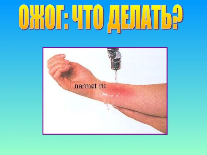 ОЖОГ: ЧТО ДЕЛАТЬ?