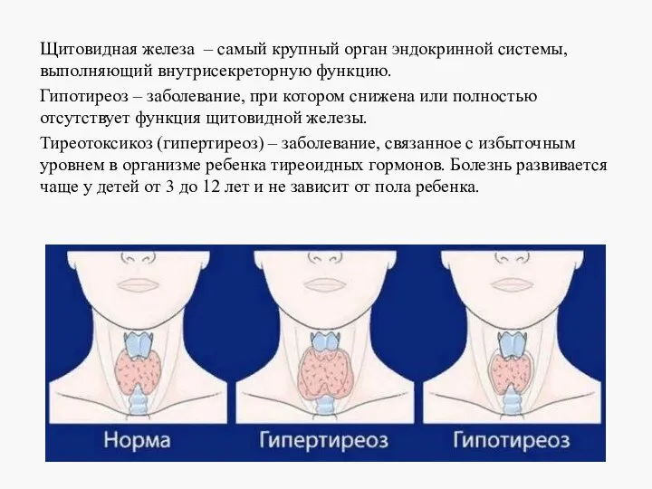 Щитовидная железа – самый крупный орган эндокринной системы, выполняющий внутрисекреторную функцию. Гипотиреоз